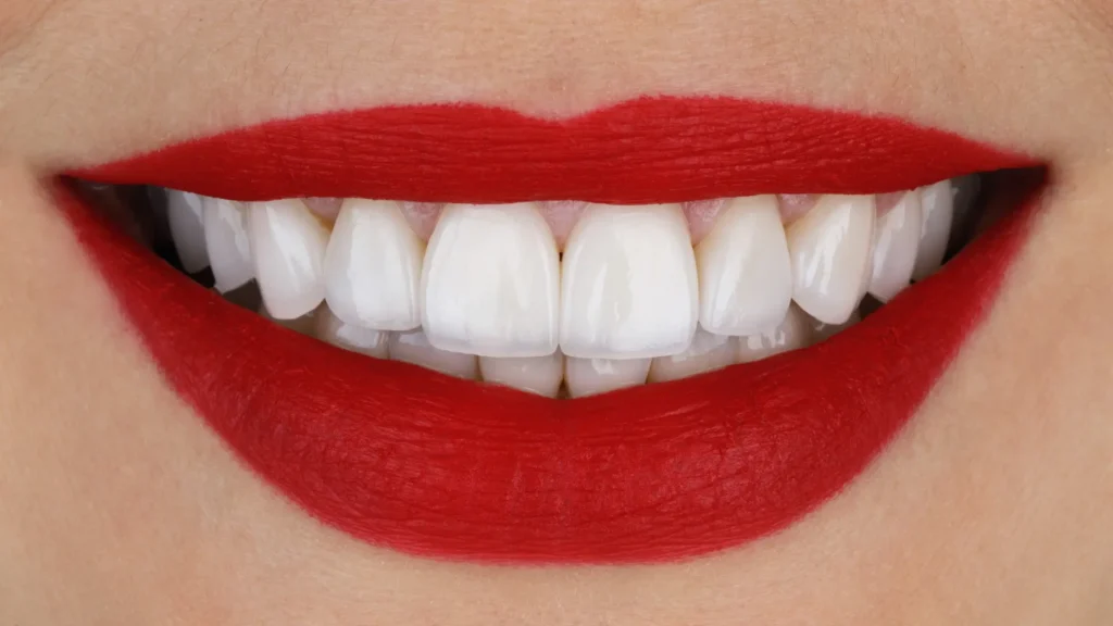 corail esthetique le sourire hollywoodien